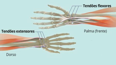 Tendinite No Pulso Principais Causas Sintomas E Tratamentos