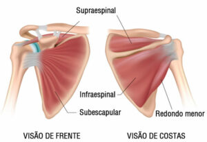 Tendinite No Ombro Sintomas Causas E Tratamento Mundoboaforma