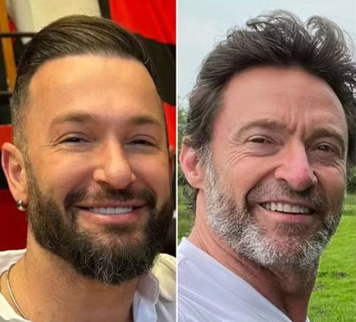 Diego-Hypolito-e-Hugh-Jackman