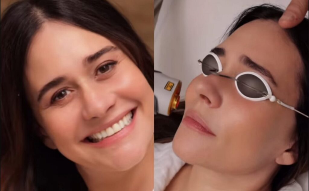 Alessandra Negrini detalha procedimento estético para rejuvenescimento: "Tratamento de beleza favorito"